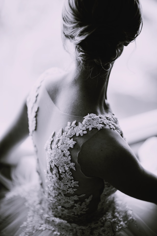 Aesthetic treatments to have before your wedding day by Aestheticlinix in Wigan